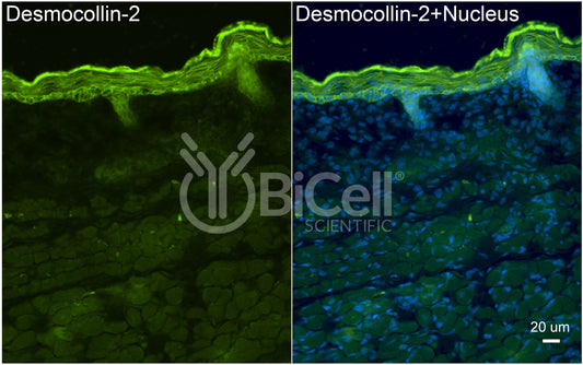 Desmocollin-2 (DSC2) Antibody