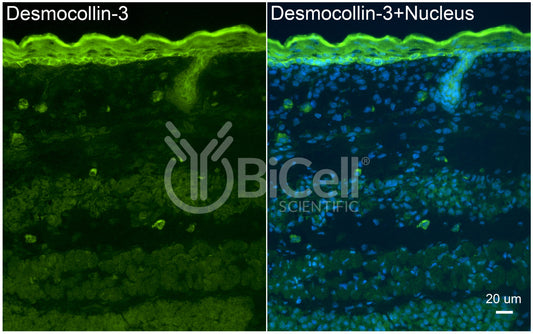 Desmocollin-3 (DSC3) Antibody - FFPE Validated