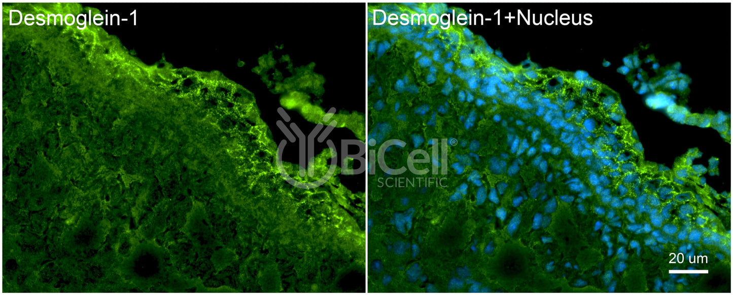 Desmoglein-1 (DSG1) Antibody