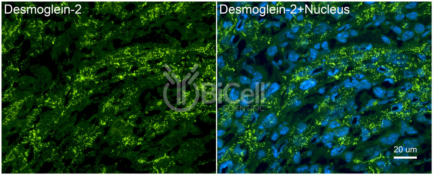 Desmoglein-2 (DSG2) Antibody - FFPE Validated