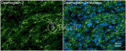 Desmoglein-2 (DSG2) Antibody - FFPE Validated