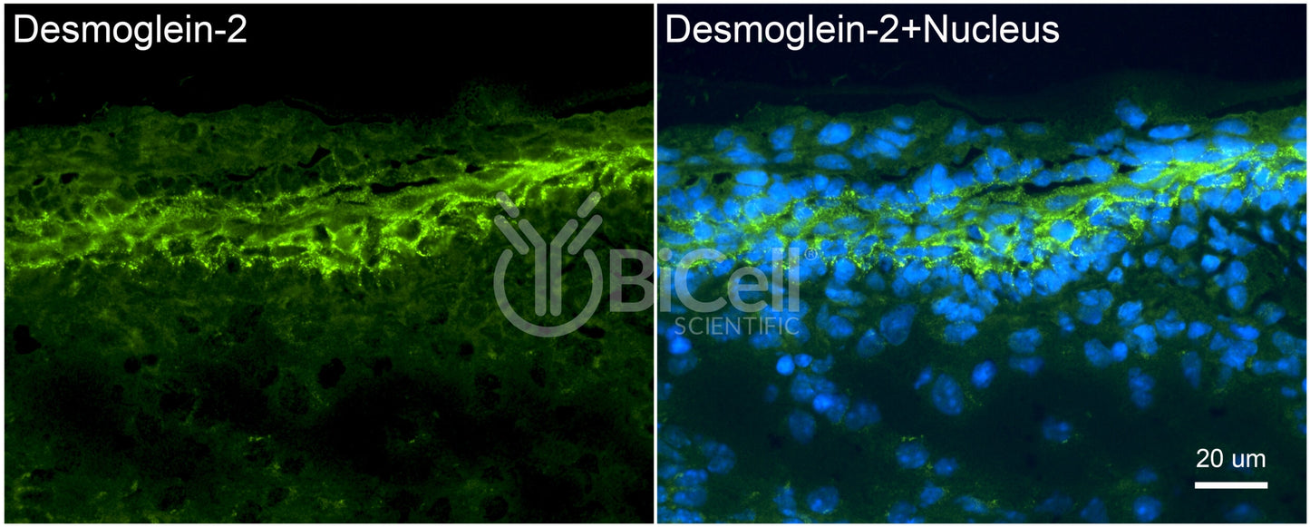 Desmoglein-2 (DSG2) Antibody - FFPE Validated