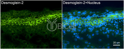Desmoglein-2 (DSG2) Antibody - FFPE Validated