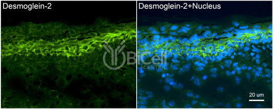 Desmoglein-2 (DSG2) Antibody - FFPE Validated