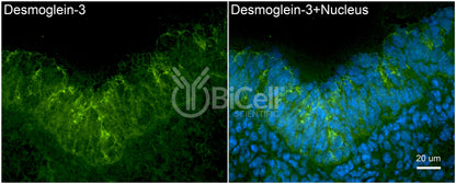 Desmoglein-3 (DSG3) Antibody - FFPE Validated