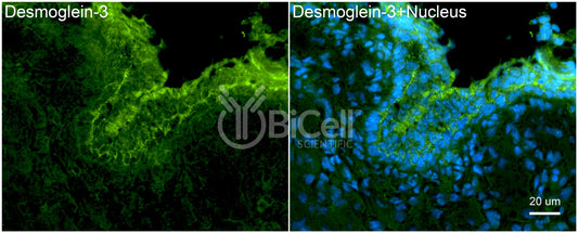 Desmoglein-3 (DSG3) Antibody - FFPE Validated