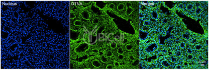 Dystrobrevin alpha (DTNA) Antibody - Western Blot Validated