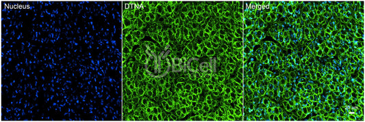 Dystrobrevin alpha (DTNA) Antibody - FFPE Validated