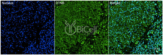 Dystrobrevin beta (DTNB) Antibody - FFPE Validated