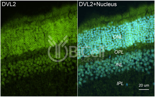 DVL2 Antibody