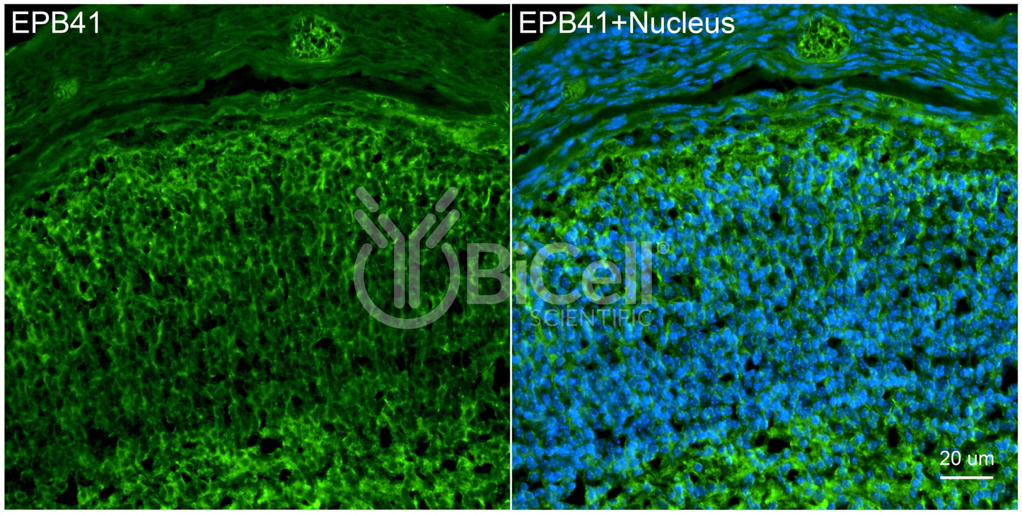 EPB41 Antibody - Western Blot Validated