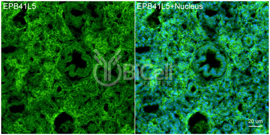 EPB41L5 Antibody - Western Blot Validated