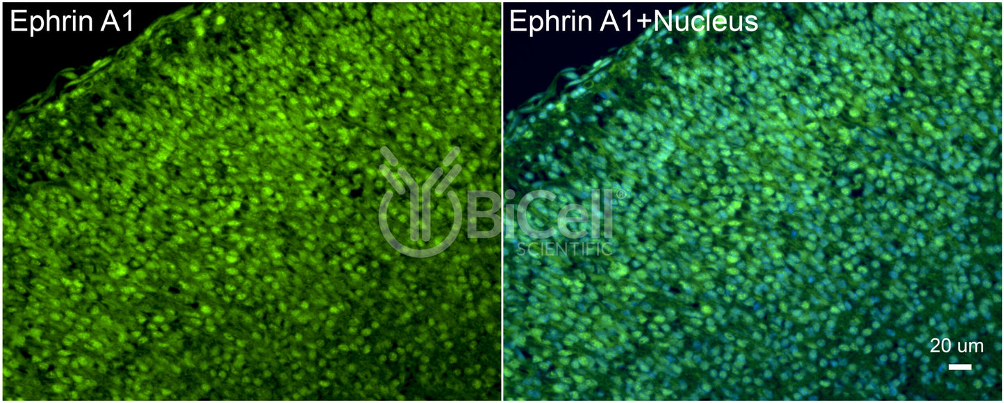 Ephrin A1 (EFNA1) Antibody - FFPE Validated