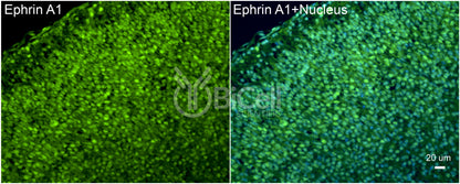 Ephrin A1 (EFNA1) Antibody