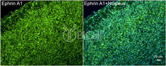 Ephrin A1 (EFNA1) Antibody