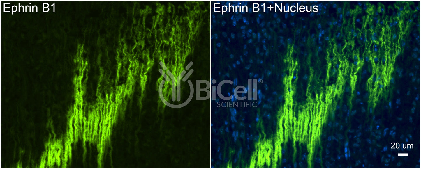 Ephrin B1 (EFNB1) Antibody - FFPE Validated