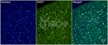 EMX1 Antibody - FFPE Validated