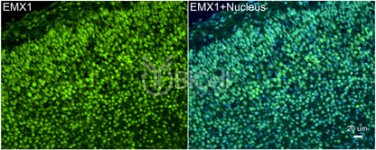 EMX1 Antibody - FFPE Validated