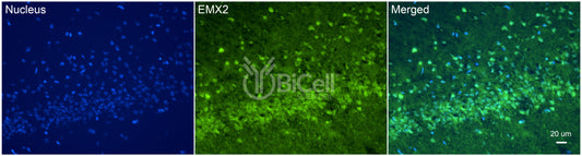 EMX2 Antibody - FFPE Validated