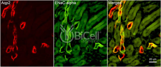 ENaC alpha (Scnn1a) Antibody - Western Blot Validated