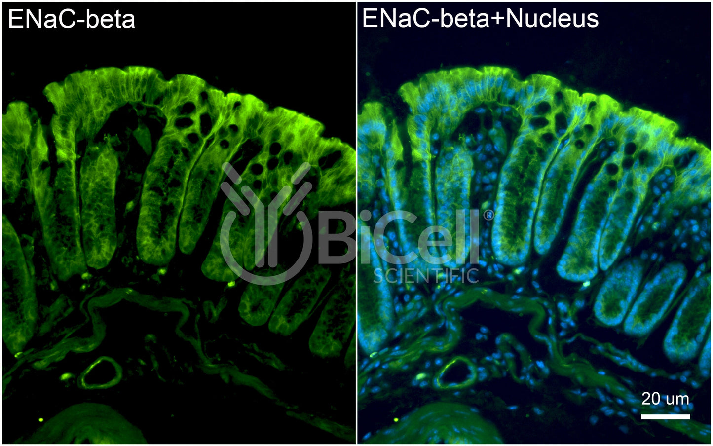 ENaC beta (Scnn1b) Antibody - FFPE Validated
