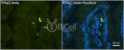 ENaC beta (Scnn1b) Antibody