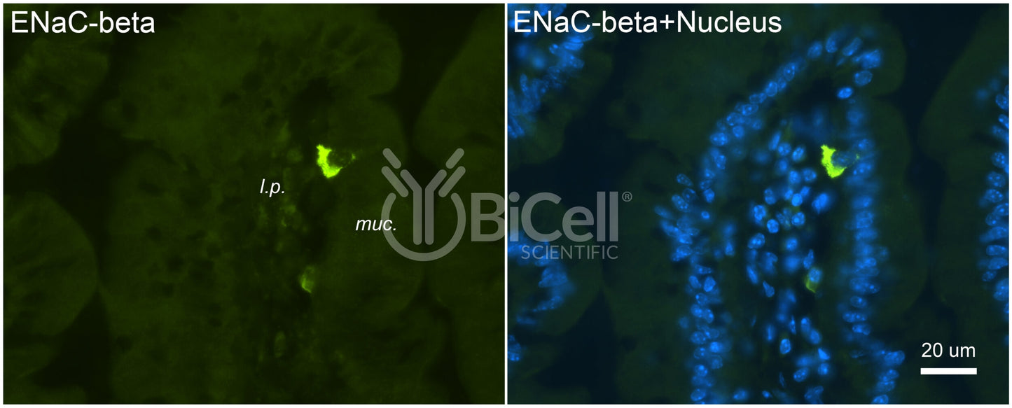 ENaC beta (Scnn1b) Antibody - FFPE Validated