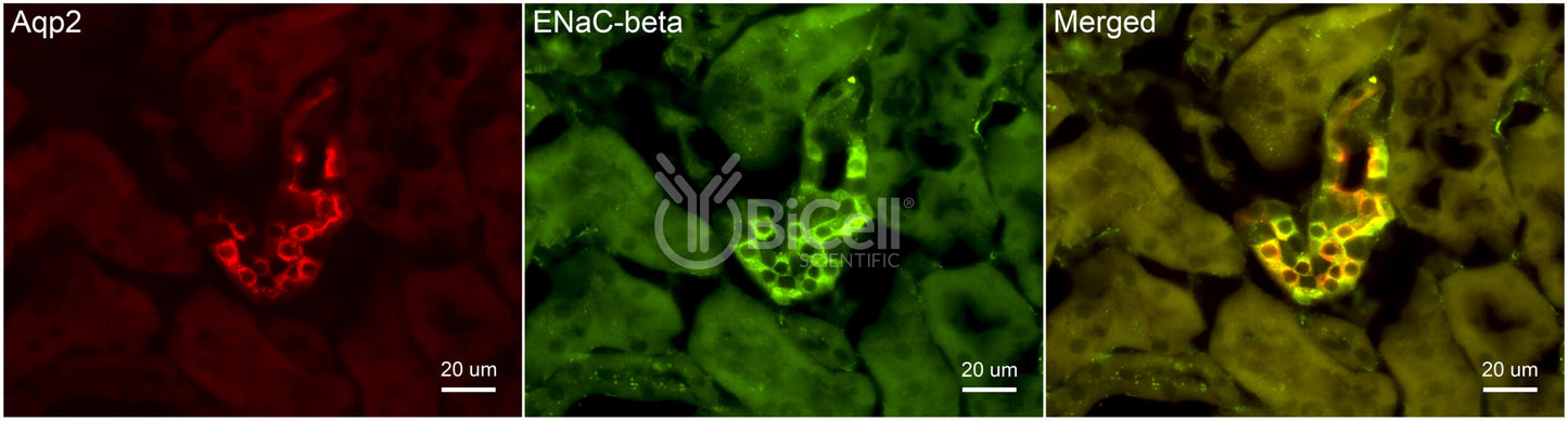 ENaC beta (Scnn1b) Antibody