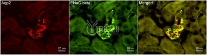 ENaC beta (Scnn1b) Antibody - FFPE Validated