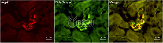 ENaC beta (Scnn1b) Antibody - FFPE Validated