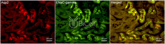ENaC gamma (Scnn1g) Antibody - Western Blot Validated