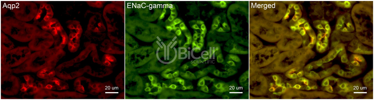 ENaC gamma (Scnn1g) Antibody