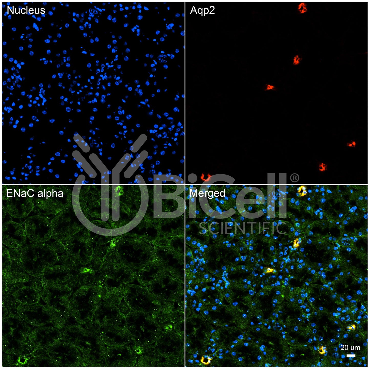 ENaC alpha (Scnn1a) (N-Terminus) Antibody - FFPE Validated