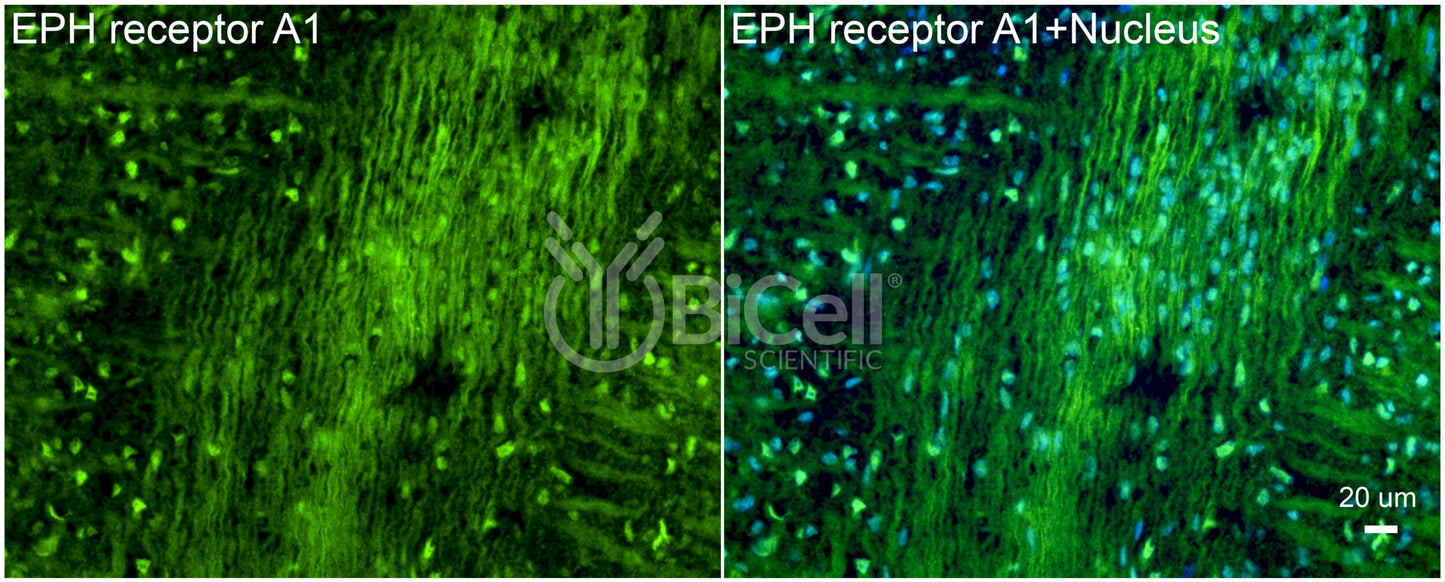 EPH receptor A1 (EPHA1) Antibody - Western Blot Validated