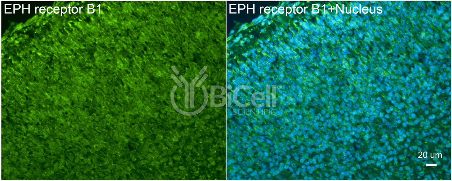 EPH receptor B1 (EPHB1) Antibody - Western Blot Validated
