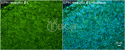 EPH receptor B1 (EPHB1) Antibody