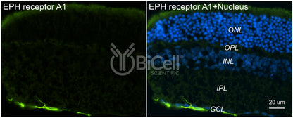 EPH receptor A1 (EPHA1) Antibody - Western Blot Validated