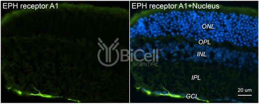 EPH receptor A1 (EPHA1) Antibody
