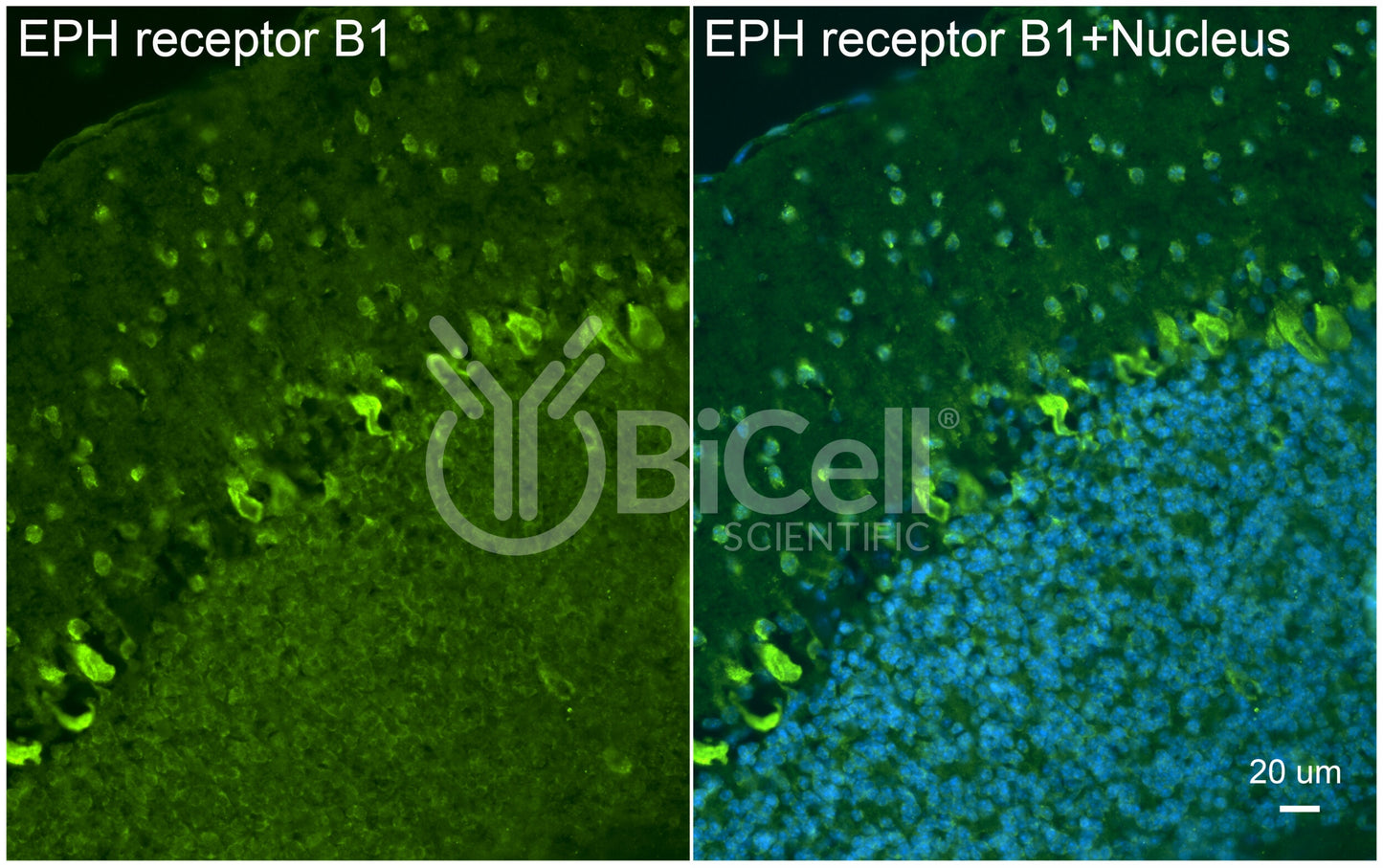 EPH receptor B1 (EPHB1) Antibody - Western Blot Validated