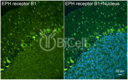 EPH receptor B1 (EPHB1) Antibody - Western Blot Validated