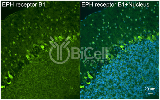 EPH receptor B1 (EPHB1) Antibody - Western Blot Validated