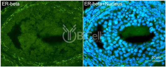 ER beta (ESR2 or NR3A2) Antibody