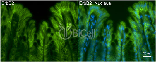 ErbB2 (HER2 or Neu or CD340) Antibody - FFPE Validated