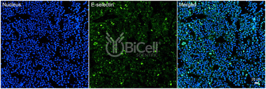 E-selectin (SELE or LECAM2 or CD62E) Antibody