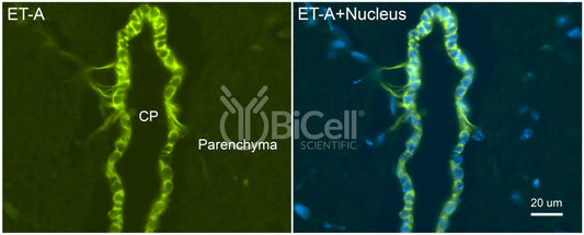 Ednra (ET-A) Antibody - FFPE Validated