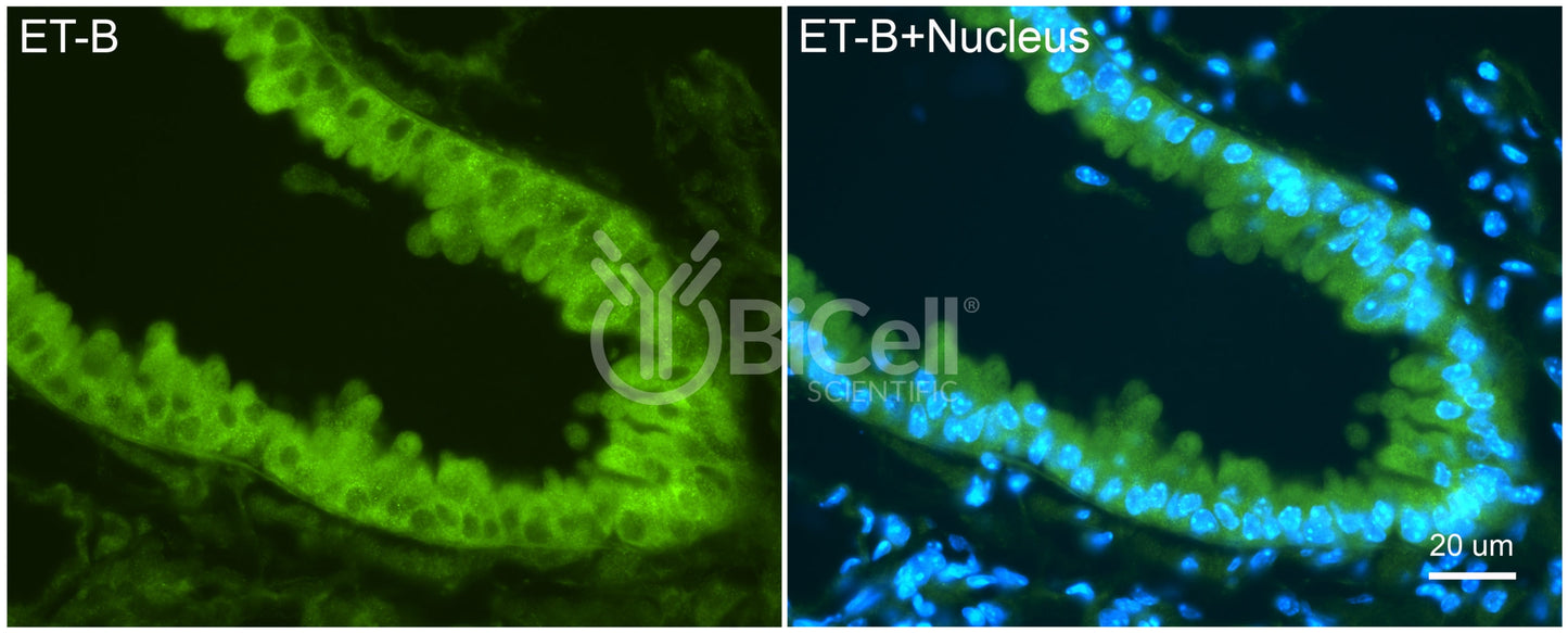 Ednrb (ET-B) Antibody
