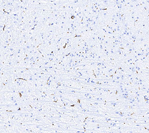 Calbindin-D-28K Antibody