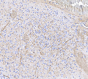 Neurofilament-L Antibody