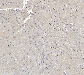 Huntingtin Antibody