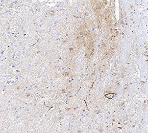 CaMKII-α Antibody